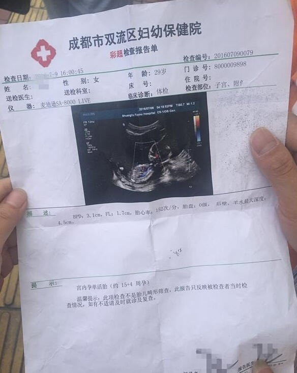 成都女子引产闹乌龙 1个月后胎儿"复生"