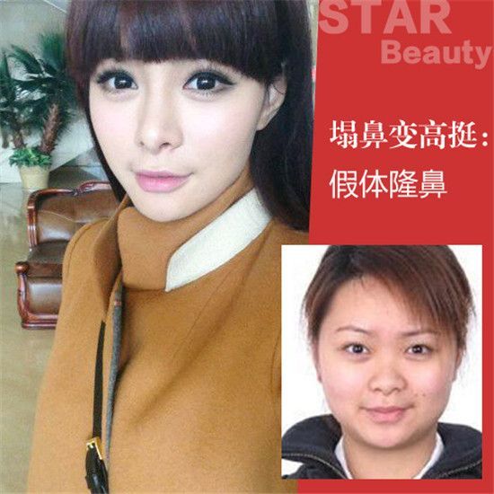 沈梦辰杜海涛恋情曝光前,很多人都不知道这个女孩,主持完《我是歌手3》巅峰会后,一时间声名鹊起,上网的人都认识她了。最近又因整容炒的火热,上哪都能看到她的新闻,让人不得不感叹,原来整容也能整出名啊!编辑我已对这个看脸的世界表示绝望了。 整容整得好,可以少奋斗十年。沈梦晨当年的长相还算清秀,可是肉肉的脸蛋小小的眼睛跟现在的女神模样完全不搭边,现在的她不仅变好看了,而且变年轻了有米有。且让我为大家一一分析她面部的整容疑点。