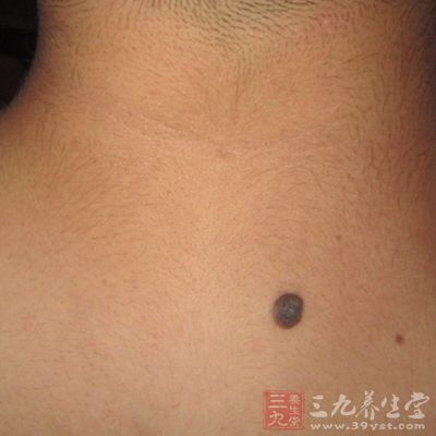 那么如何才能有效预防黑痣癌变呢?